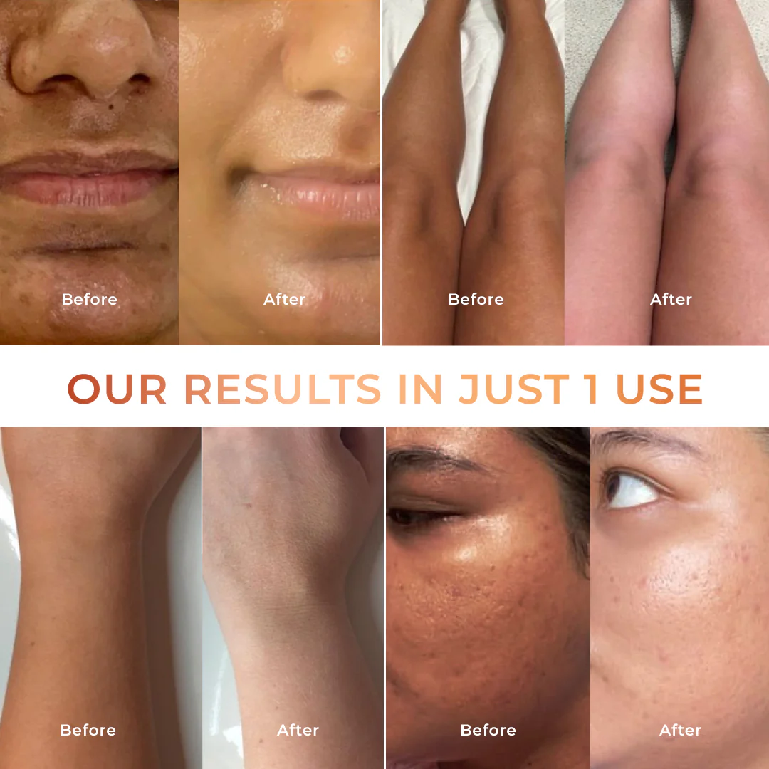 Niconi Tan Vanish Gluta-Kojic Skin Polish 180g (₹80 per use) - Image 6