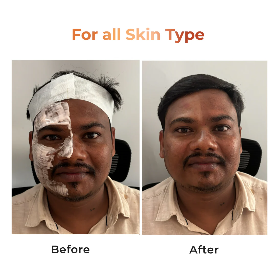 Niconi Tan Vanish Gluta-Kojic Skin Polish 180g (₹80 per use) - Image 3