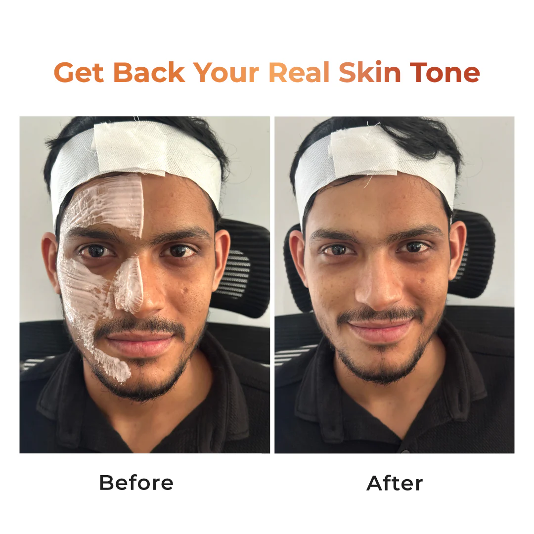 Niconi Tan Vanish Gluta-Kojic Skin Polish 180g (₹80 per use) - Image 5
